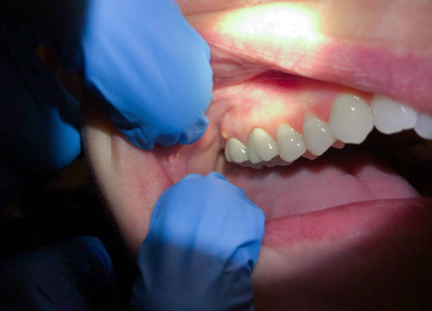 Best Emergency Denture Repair in Wagon Wheel, AZ