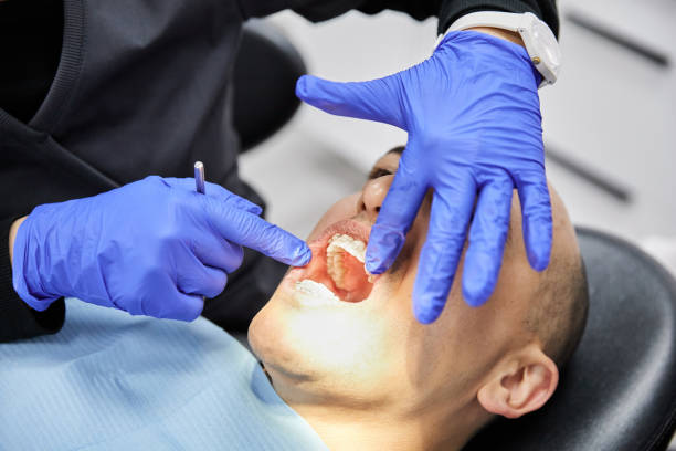 Best Emergency Dental Care for Sports Injuries in Wagon Wheel, AZ