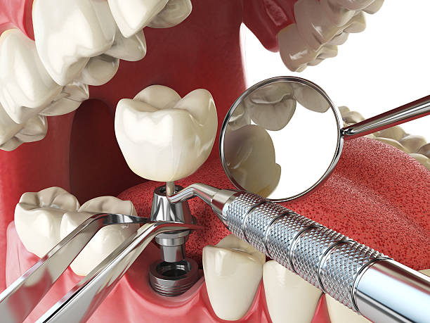 Best Emergency Treatment for Jaw Pain or Injury in Wagon Wheel, AZ